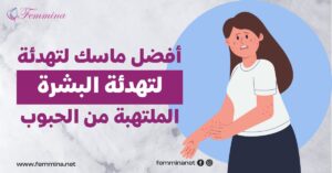 افضل ماسك لتهدئة البشرة الملتهبة من الحبوب