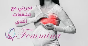 تجربتي مع تشققات الثدي