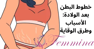 خطوط البطن بعد الولادة