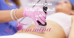 علاج تشققات البطن بعد الولادة بالليزر